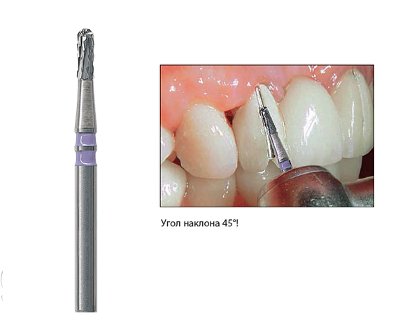 Боры для разрезания различных видов коронок. NTI H4KMKL-012-FG