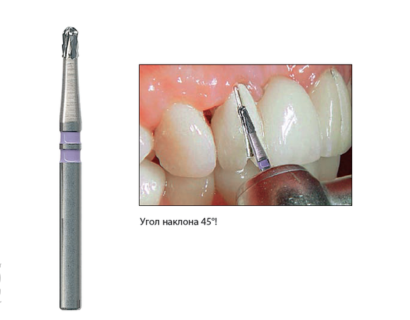 Боры для разрезания различных видов коронок. NTI H4KMK-010-FG