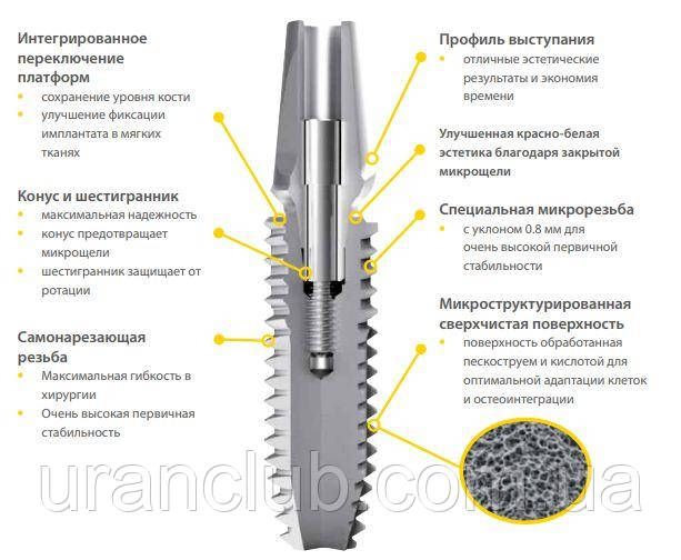 Імпланти системи IMPLA Циліндричні з конічним з'єднанням діаметр 3,6 мм, довжина 8 мм