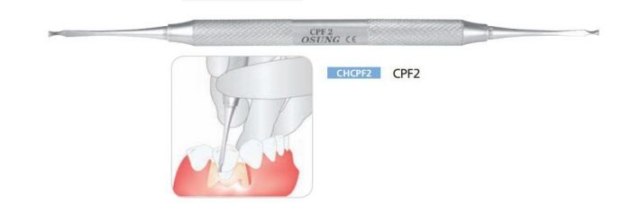 Долото (хірургічний інструмент) Osung Долото періостальними CHCPF2