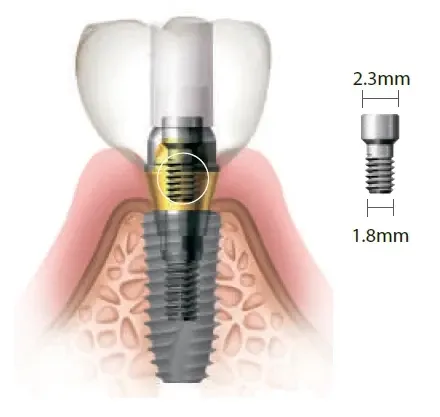 Винт фиксирующий SuperLine