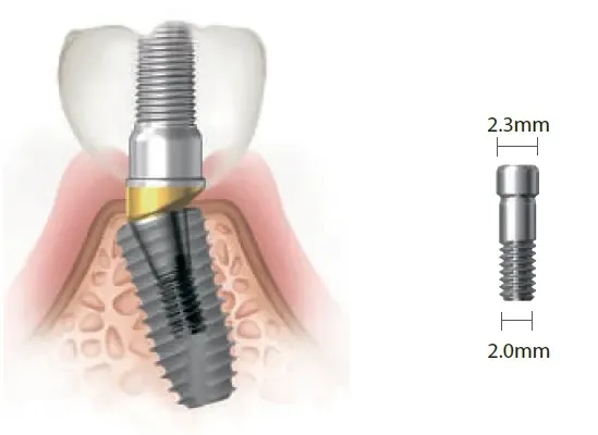 Винт фиксирующий SuperLine для двойного / обтачуваного / углового / временного / литейного абатментов, диам. = 2.3 / 1.28мм, № ASC2045