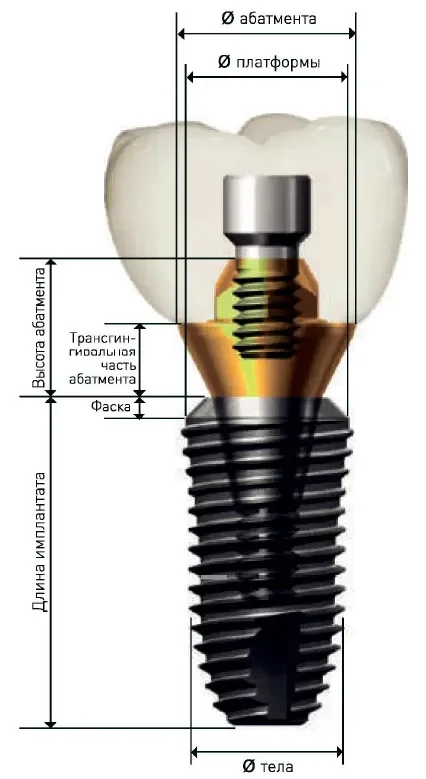 Имплантат SuperLine платформа = 3.6мм, тело = 3.4мм, длина = 7мм, № FX3607SW