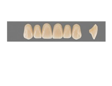 VITA MFT верхние фронтальные, цвет 3L1.5, размер T49