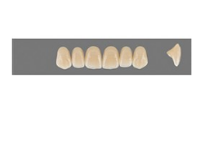 VITA MFT верхние фронтальные, цвет 2M1, размер R42