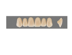 VITA MFT верхние фронтальные, цвет 2L1.5, размер T49
