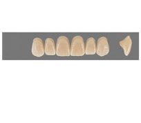 VITA MFT верхние фронтальные, цвет 2L1.5, размер S47