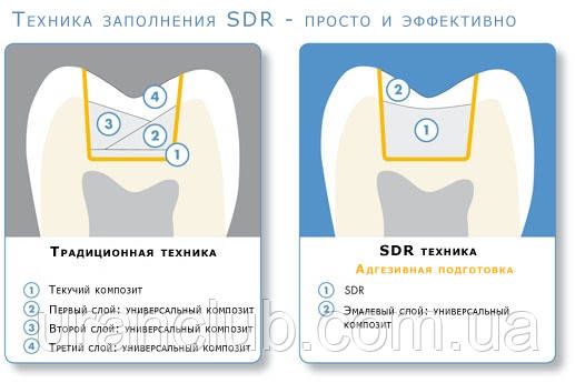 Композит для реставрації бокової групи зубів SDR, Dentsply шпр. 1 гр.