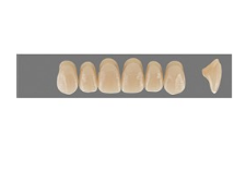 VITA MFT верхние фронтальные, цвет 2L1.5, размер O49