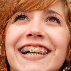 Ортодонтическая продукция MORELLI